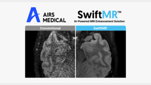 에어스메디컬, 獨·英·日에 MRI AI 솔루션 SwiftMR™ 공급 계약 체결