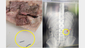 “한우 먹다 주삿바늘 삼켜”…엑스레이 찍었더니 위장에