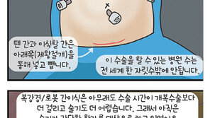 [만화 그리는 의사들]〈323〉복강경-로봇 간이식