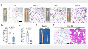 KAIST, 지방세포 이용해 체중 줄이는 방법 제시 ‘눈길’