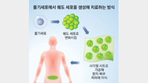 인슐린 주사 없는 당뇨 줄기세포 치료, 내년 시험