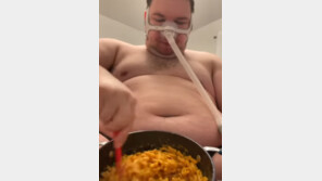 171㎏ 호흡기 끼던 먹방 유튜버…7개월 만에 놀라운 근황