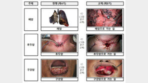 ‘폐암으로 가는 길’ 담뱃갑 경고 더 세진다…23일부터 새 그림 적용