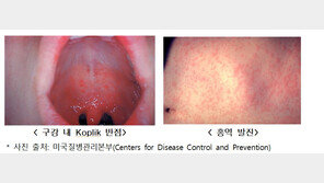 홍역 환자 5년 만에 최다…“해외여행 시 백신 접종 필수”