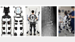 로봇 입고 재활했더니…척추 수술 환자 일상생활능력 38.6%↑