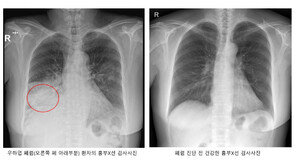 “곧 개학인데”…독감 2차 유행에 합병증 폐렴까지 ‘비상’