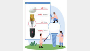 정확한 위치에 심고 정기적으로 검진해야 ‘튼튼한 임플란트’