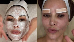 K-뷰티 시술 받은 ‘3억 팔로워’ 카다시안…컵라면-한식 인증샷까지