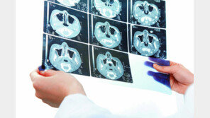 폐암 조기발견 땐 생존율 ‘쑥’… 구역 절제술로 기능 보존한다