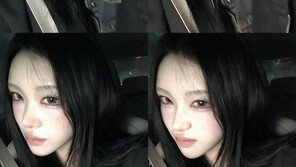 고 최진실 딸 최준희, “태초의 입술로 돌아갔다”…필러 제거 근황