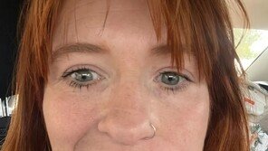 출산 며칠 만에 얼굴 마비된 英 여성…“눈은 손으로 감아야”