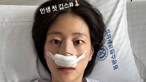 이현이, 축구 경기 중 코뼈 골절…“의욕 앞서, 인생 첫 깁스”