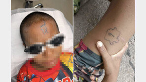 10살 소년 이마에 ‘외설 타투’…잔혹한 학교폭력에 태국 발칵