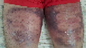 경계선지능인 홍두깨 폭행 의혹…경기 광주경찰서가 수사