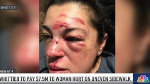 길 걷다 넘어진 美여성, 보상금 106억에 市와 합의…무슨 일?