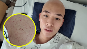 백혈병 차현승 “모세혈관 자꾸 터져” 붉은점 빼곡