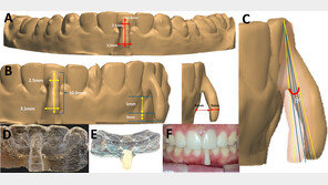  홍경재 시스루테크 대표, AJO-DO Clinical Companion에 비수술 잇몸퇴축 치료 논문 등재