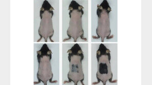 “3주 만에 풍성” 바르는 새 탈모 치료제 개발…임상시험 단계