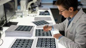 뇌졸중 논문서 ‘사진 재탕’ 무더기 발견