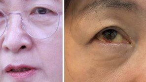 추미애 “눈에 실핏줄 터졌다”…주진우 “윽박지르다 터져”