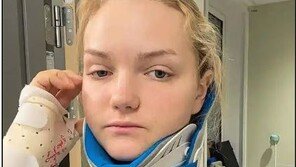 “사자에게 목 물리고도 살았다”…사파리서 기적 생존