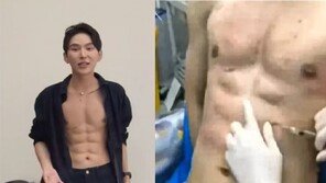 “운동 대신 주사 40번”…8억 들여 인공 복근 만든 中 남성