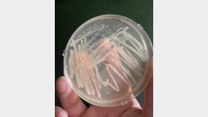 슬리퍼 없이 샤워 금물…헬스장 바닥에서 세균 폭발