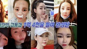 “성형만 1억4000”… 39세 트랜스젠더, 20번 수술 후 또 고민
