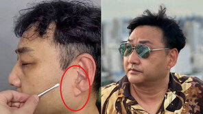 쓰러진 김수용 귓불에 깊은 사선 주름…심혈관 이상 전조?