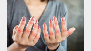 키보드 많이 치면 생기는 병…중년층에서 특히 잘 생기는 이 질환은?