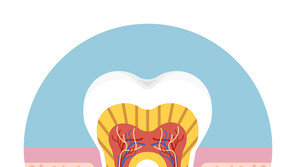 치아 신경치료, 뜻밖의 부수 효과 “당뇨·심장병 위험 감소”