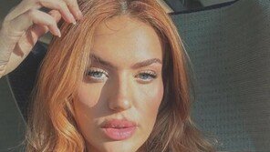 자궁 2개 가진 여성들…“한달에 생리 두번” “기적처럼 쌍둥이 출산도”