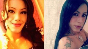 ‘엉터리 시술’ 탓 얼굴 무너진 30대 인플푸언서 “광고 계약 다 끊겼다”