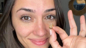 35년 된 ‘코딱지’?…신생아 때 박힌 테이프 뭉치 제거 성공