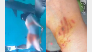 생리중에도 인생샷 찍으려 다이빙…상어에 공격당했다