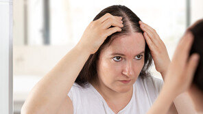 ‘산타 모자·촬영 부스 소품’ 돌려쓰면 탈모 온다?…전문가 견해는