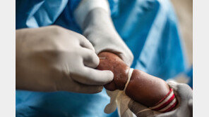 아시아 여행 후 고열·발진…英서 신종 변이 바이러스 발견