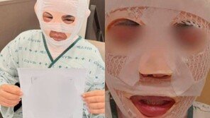 경찰, 태국인 아내 얼굴에 뜨거운 물 부은 남편에 구속영장