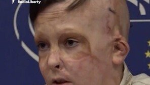 母 잃고 36번의 수술 이겨낸 우크라 소년의 호소 “계속 도와주세요”