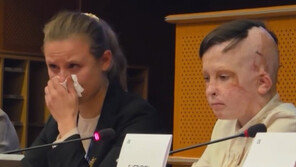 러 공습에 36회 수술 우크라 소년 “절대 포기 안돼”