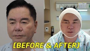 심형래, 안면거상술 받았다…“얼굴 리모델링 해 유튜브”