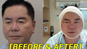 심형래, 안면거상술 받았다…“얼굴 리모델링 해 유튜브”