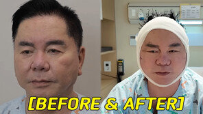 심형래, 안면거상술 받았다…“얼굴 리모델링 해 유튜브”