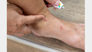 “비행기서 빈대 나와 여행 망쳐” 3억 원대 소송