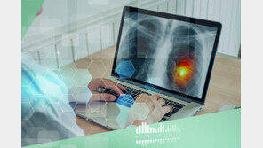 건강검진 흉부 엑스레이 대상 연령 확 올라간다…20세→50세 이상