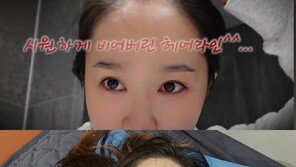 “듬성 비었었는데…” 헤이지니, 모발이식 비포·애프터 공개