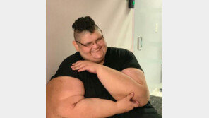 600kg 멕시코男, 400kg 감량 성공했지만 합병증 사망