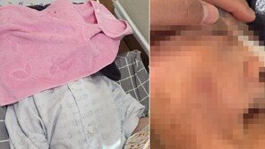 “노모 숨 못 쉬게 수건 덮어놨다”…요양병원 보호자 분노