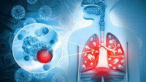 감기와 증상 비슷한 폐렴…‘이 질환’ 환자들엔 더 치명적