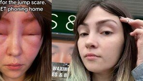 “눈썹 염색하다 ‘외계인’ 됐다”…알레르기 테스트의 중요성